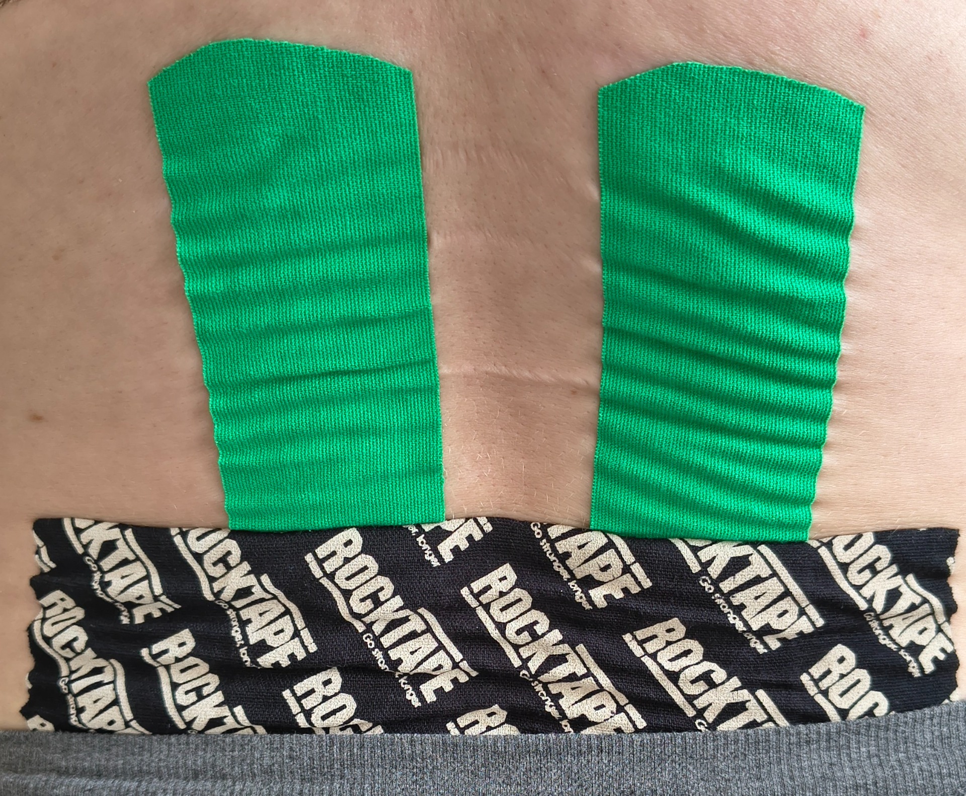Příklad tejpování bederní páteře