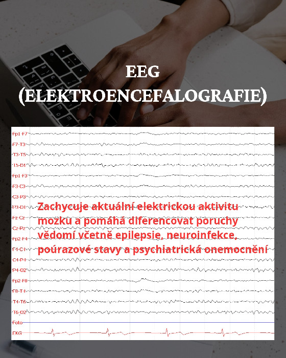 Neurology Mištríková | EEG